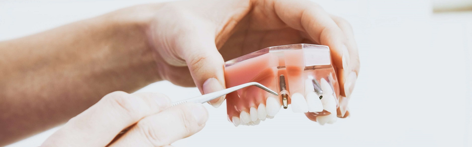 Pallet racks LAVA systems | Dental implants Belgrade